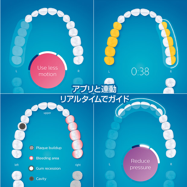 BBIQ特選ショップ | 【PHILIPS】ソニッケアー ダイヤモンド BBIQ特選ショップ | 【PHILIPS】ソニッケアー ダイヤモンド